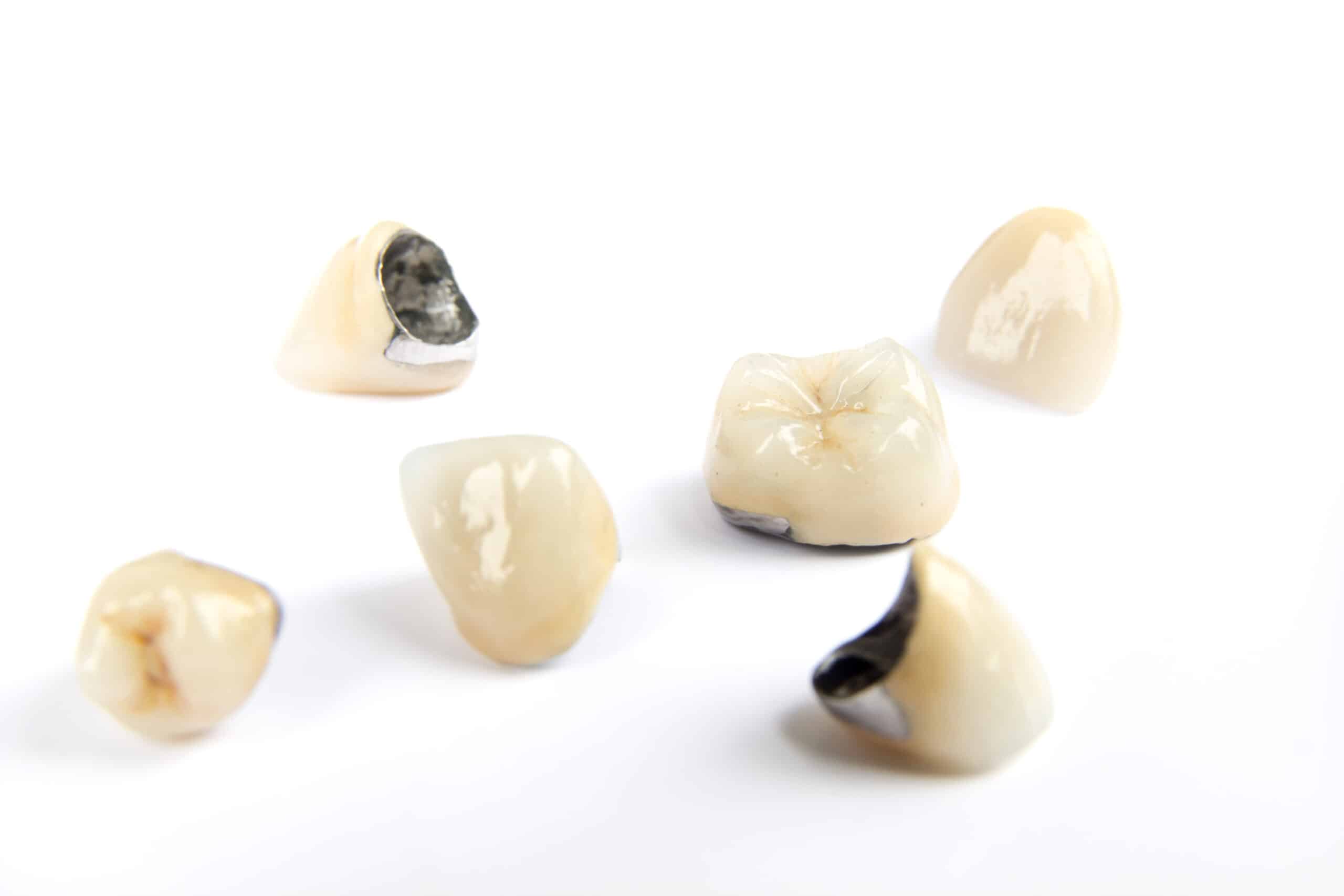 Same-Day Crowns vs. Traditional Crowns Same-Day Crowns vs. Traditional Crowns
