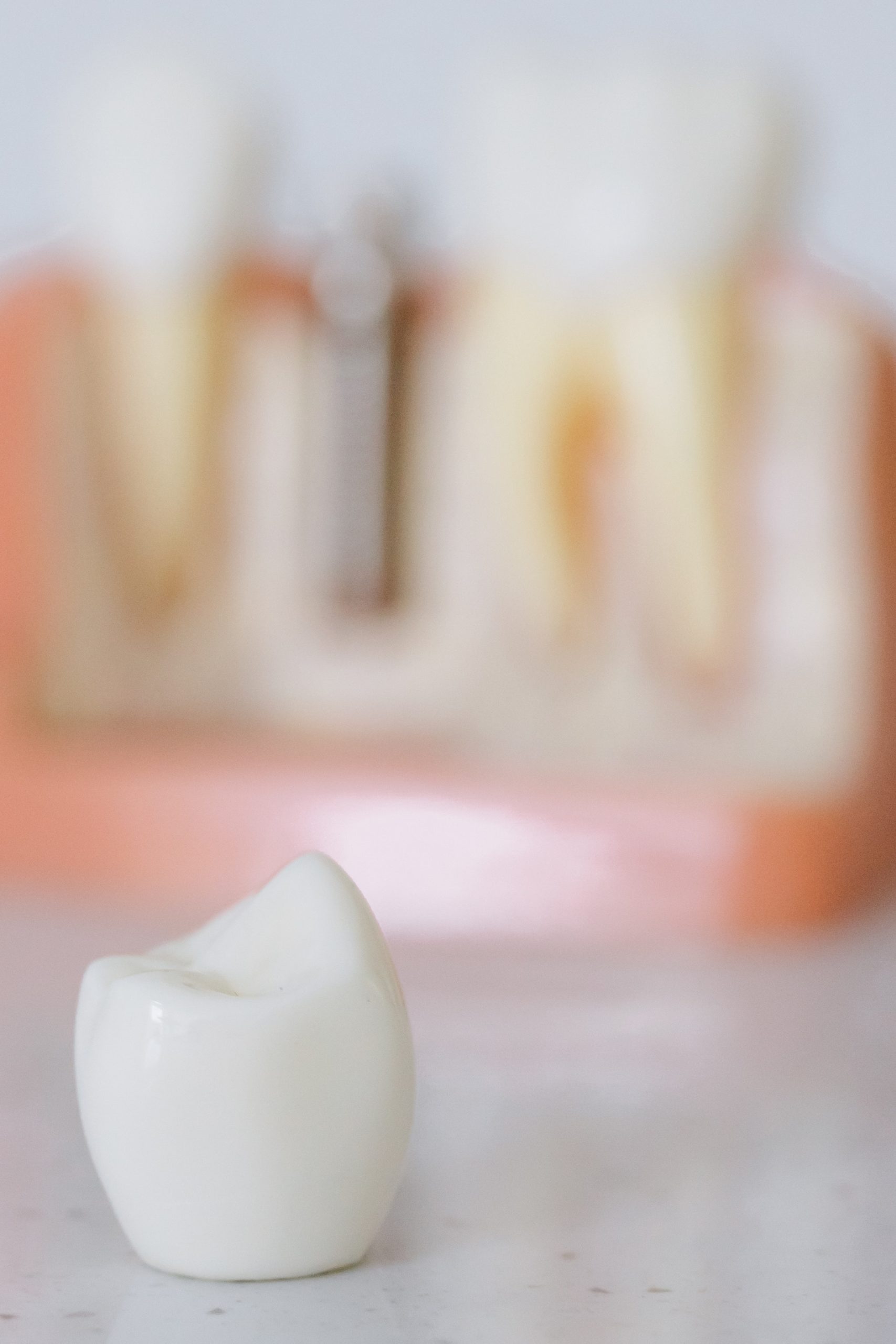 What you Should Know About Dental Implants