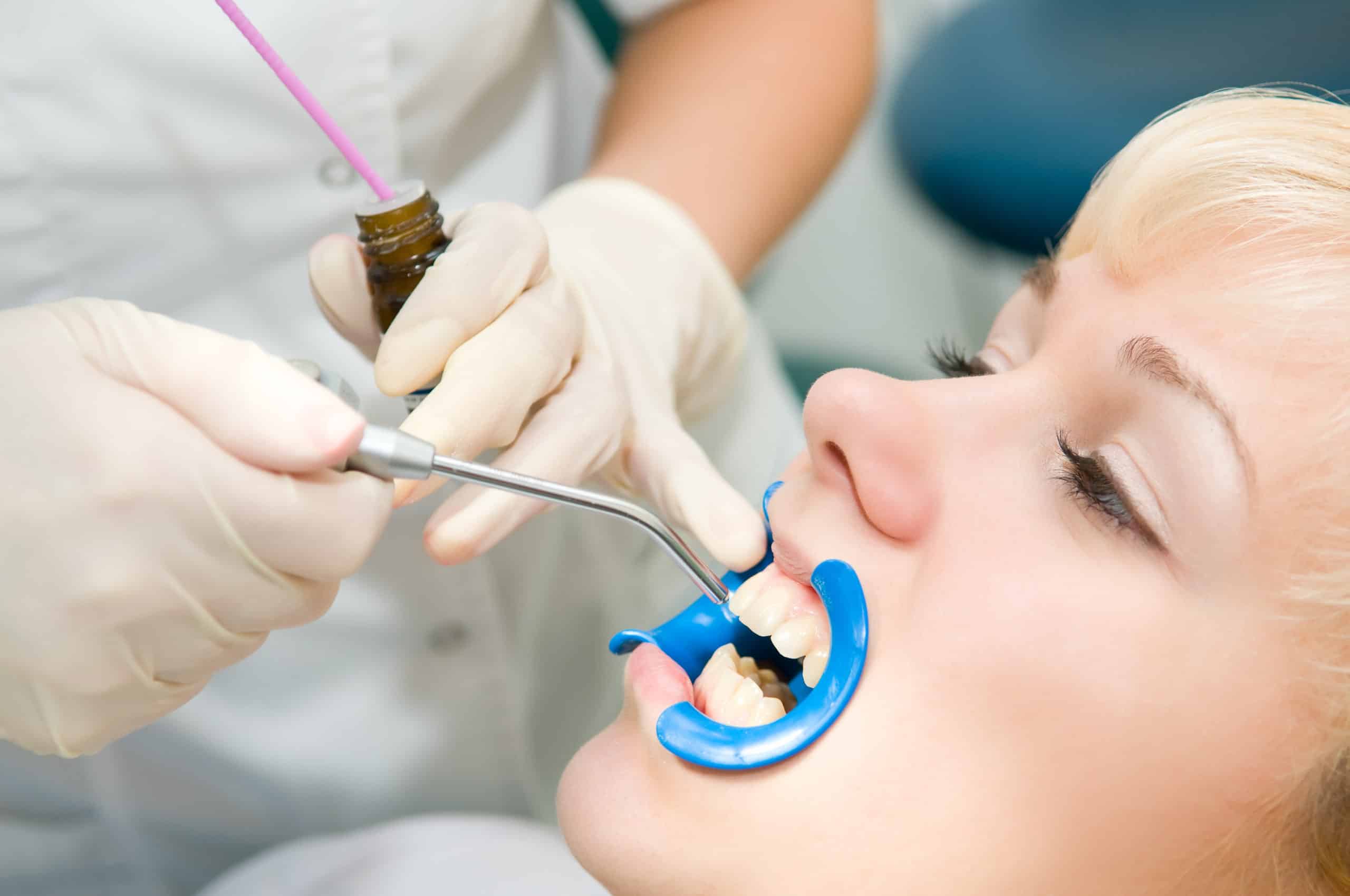 Tooth Extraction, Dentist, Dental Work