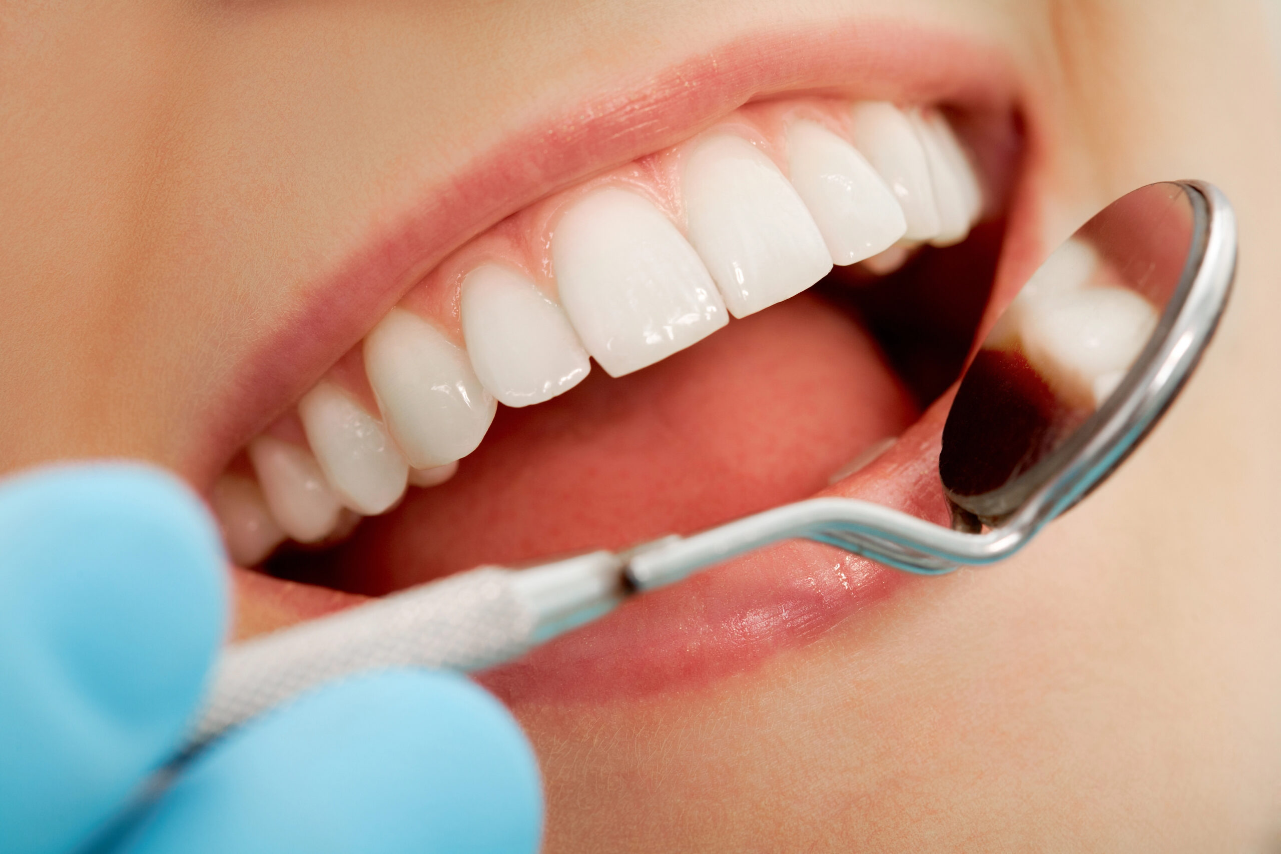Remove calculus from your teeth in Hendersonville, NC