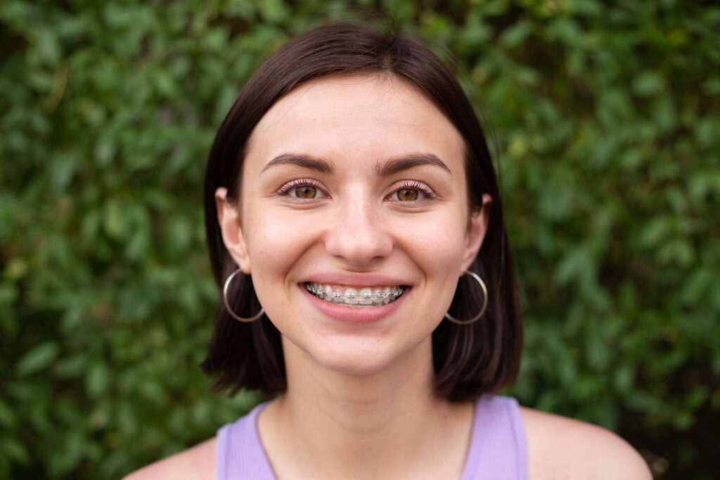 Tooth gems in Hendersonville, NC