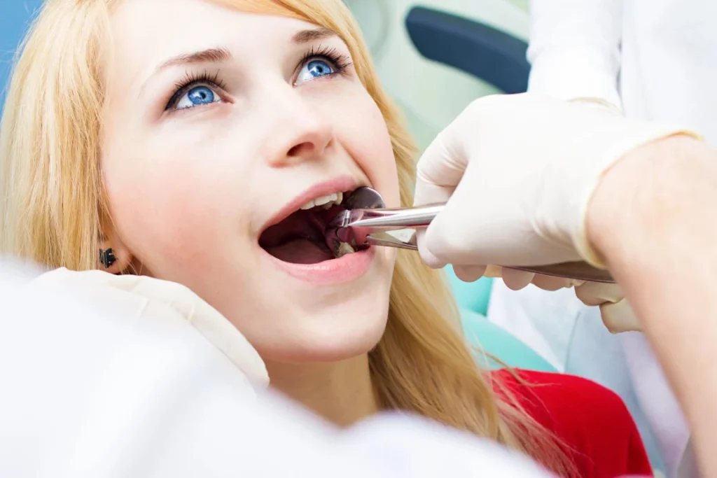Impacted Wisdom Teeth: Understanding the Signs and When to Schedule Removal Impacted wisdom teeth in Hendersonville, NC